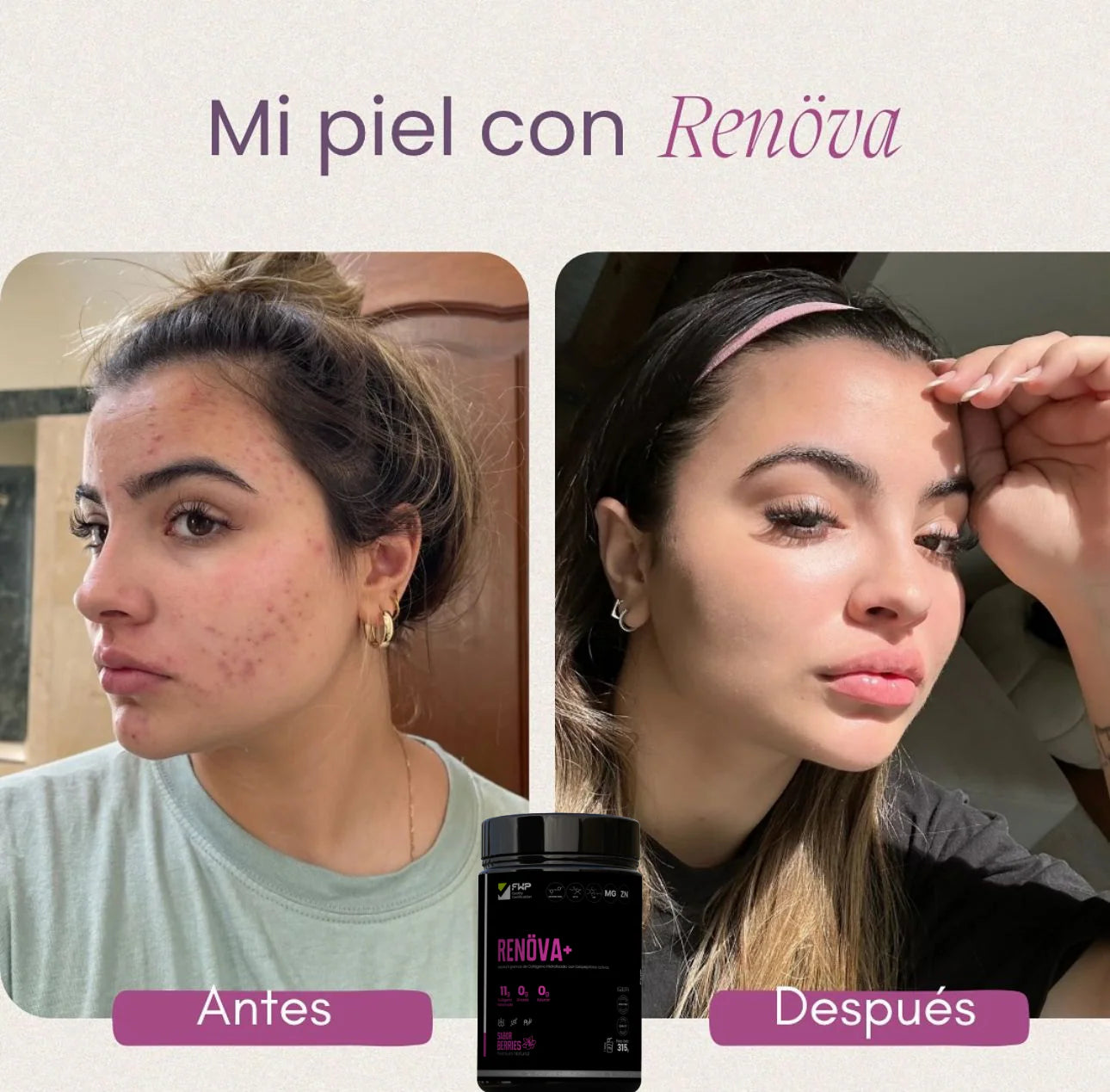 RENÖVA+ Colágeno Doblemente Hidrolizado